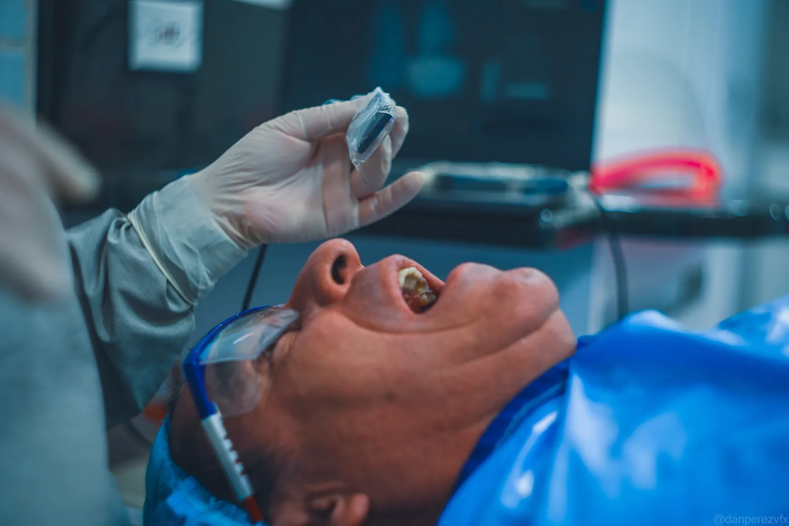 Escáner intraoral usado en el estudio de ortodoncia