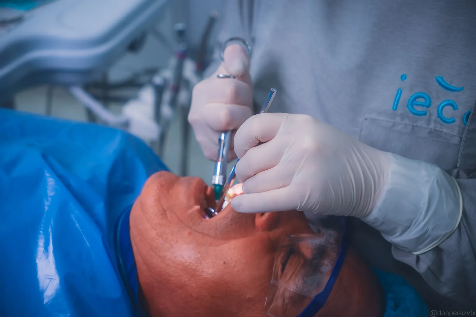 Procedimiento de cirugía oral